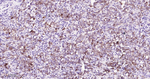 SQSTM1 Antibody in Immunohistochemistry (Paraffin) (IHC (P))