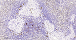 SQSTM1 Antibody in Immunohistochemistry (Paraffin) (IHC (P))