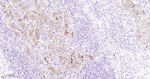 SQSTM1 Antibody in Immunohistochemistry (Paraffin) (IHC (P))