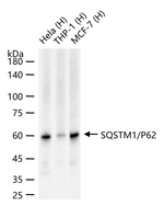 SQSTM1 Antibody in Western Blot (WB)