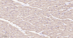 ACADM Antibody in Immunohistochemistry (Paraffin) (IHC (P))