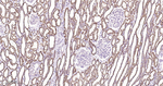 ACADM Antibody in Immunohistochemistry (Paraffin) (IHC (P))
