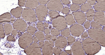 Thyroglobulin Antibody in Immunohistochemistry (Paraffin) (IHC (P))