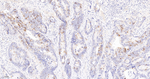 Cyclin B1 Antibody in Immunohistochemistry (Paraffin) (IHC (P))