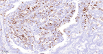 Cyclin B1 Antibody in Immunohistochemistry (Paraffin) (IHC (P))