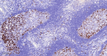 Cyclin B1 Antibody in Immunohistochemistry (Paraffin) (IHC (P))