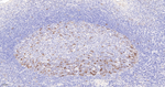 Cyclin B1 Antibody in Immunohistochemistry (Paraffin) (IHC (P))