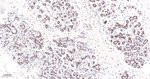 FOXO3A Antibody in Immunohistochemistry (Paraffin) (IHC (P))