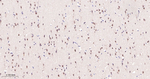 FOXO3A Antibody in Immunohistochemistry (Paraffin) (IHC (P))