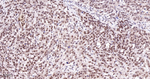 FOXO3A Antibody in Immunohistochemistry (Paraffin) (IHC (P))