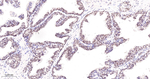 FOXO3A Antibody in Immunohistochemistry (Paraffin) (IHC (P))