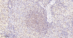 FOXO3A Antibody in Immunohistochemistry (Paraffin) (IHC (P))