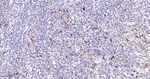FOXO3A Recombinant Rabbit Monoclonal Antibody (12A1)