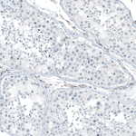 ITGA5 Antibody in Immunohistochemistry (Paraffin) (IHC (P))
