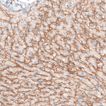 ITGA5 Antibody in Immunohistochemistry (Paraffin) (IHC (P))