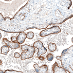 ITGA5 Antibody in Immunohistochemistry (Paraffin) (IHC (P))