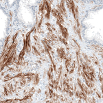 ITGA5 Monoclonal Antibody (CL6945)