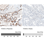 ITGA5 Antibody in Immunohistochemistry (Paraffin) (IHC (P))