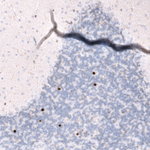 EOMES Antibody in Immunohistochemistry (Paraffin) (IHC (P))