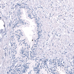 EOMES Antibody in Immunohistochemistry (Paraffin) (IHC (P))