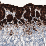 MUC5AC Antibody in Immunohistochemistry (Paraffin) (IHC (P))