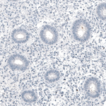 MUC5AC Antibody in Immunohistochemistry (Paraffin) (IHC (P))