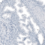 MUC5AC Antibody in Immunohistochemistry (Paraffin) (IHC (P))