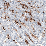 MUC5AC Antibody in Immunohistochemistry (Paraffin) (IHC (P))