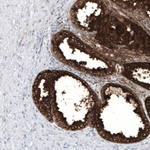 PSA Antibody in Immunohistochemistry (Paraffin) (IHC (P))