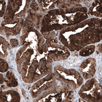 PSA Antibody in Immunohistochemistry (Paraffin) (IHC (P))