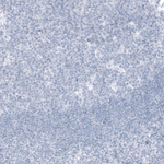 PSA Antibody in Immunohistochemistry (Paraffin) (IHC (P))