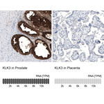 PSA Monoclonal Antibody (CL9414)