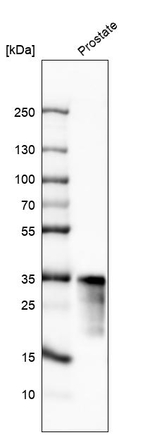 PSA Antibody in Western Blot (WB)