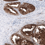 PSA Antibody in Immunohistochemistry (Paraffin) (IHC (P))