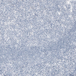PSA Antibody in Immunohistochemistry (Paraffin) (IHC (P))