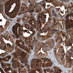 PSA Antibody in Immunohistochemistry (Paraffin) (IHC (P))