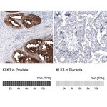 PSA Monoclonal Antibody (CL9422)