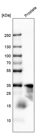 PSA Antibody in Western Blot (WB)