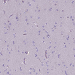 CD40 Antibody in Immunohistochemistry (Paraffin) (IHC (P))