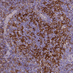 CD40 Antibody in Immunohistochemistry (Paraffin) (IHC (P))