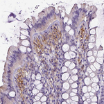 CD40 Antibody in Immunohistochemistry (Paraffin) (IHC (P))