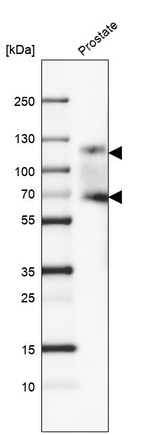 PSMA Antibody in Western Blot (WB)