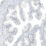 CD23 Antibody in Immunohistochemistry (Paraffin) (IHC (P))