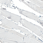CD23 Antibody in Immunohistochemistry (Paraffin) (IHC (P))