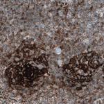CD23 Antibody in Immunohistochemistry (Paraffin) (IHC (P))