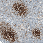 CD23 Antibody in Immunohistochemistry (Paraffin) (IHC (P))