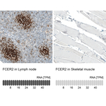 CD23 Monoclonal Antibody (CL12435)