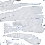 CD47 Antibody in Immunohistochemistry (Paraffin) (IHC (P))