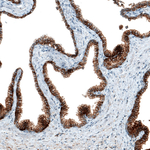 CD47 Antibody in Immunohistochemistry (Paraffin) (IHC (P))