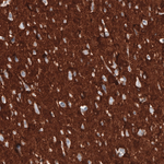 CD47 Antibody in Immunohistochemistry (Paraffin) (IHC (P))